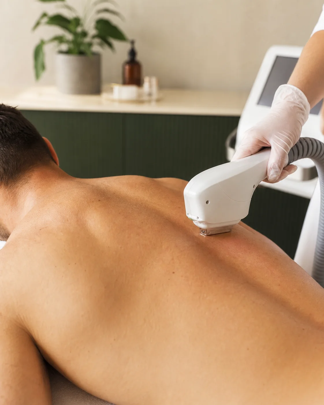 Laserhaarentfernung am Rücken eines Mannes im STELLAR Beauty Studio Nürnberg
